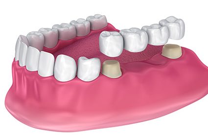 cosmetic dentistry in amalapuram