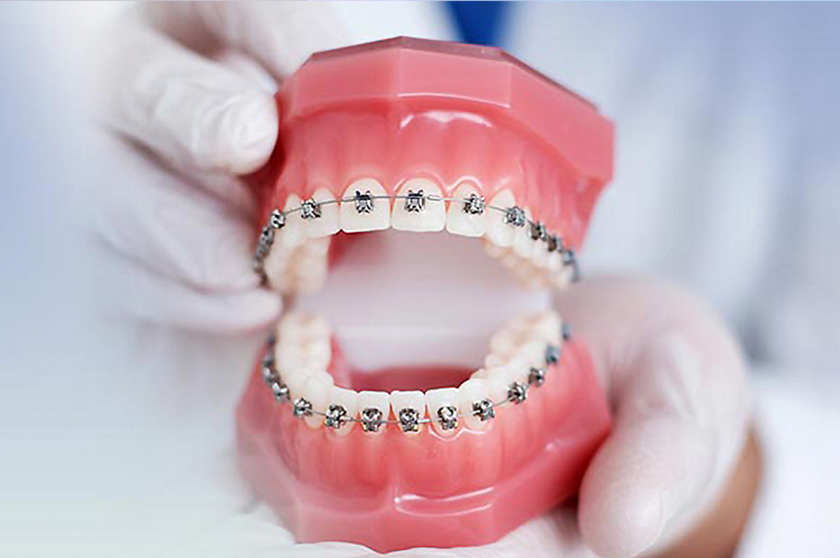 cosmetic dentistry in amalapuram