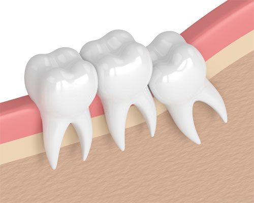 cosmetic dentistry in amalapuram
